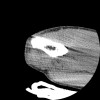 SPORK, NICO - 22.03.1976 - 02.08.2022 - CT obere Extremität - 17:51:17